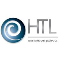 Hair Transplant Liverpool image 1